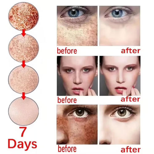 🔥7-Second Brightening: Eliminates dark spots, improves dullness, and reveals radiant skin. 🥇Vitamin C Spot-Fading Serum➡️(3 HOURS LEDFT!)
