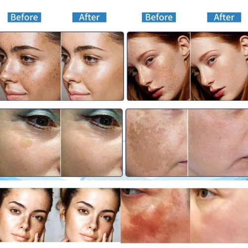 🔥7-Second Brightening: Eliminates dark spots, improves dullness, and reveals radiant skin. 🥇Vitamin C Spot-Fading Serum➡️(3 HOURS LEDFT!)