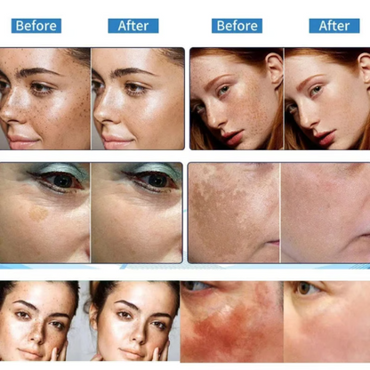 🔥7-Second Brightening: Eliminates dark spots, improves dullness, and reveals radiant skin. 🥇Vitamin C Spot-Fading Serum➡️(3 HOURS LEDFT!)